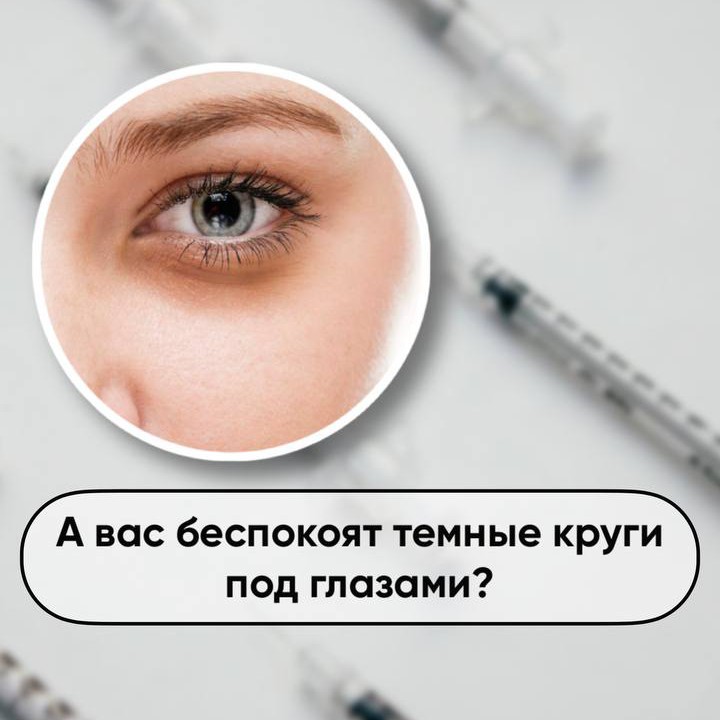Коррекция носослезной борозды