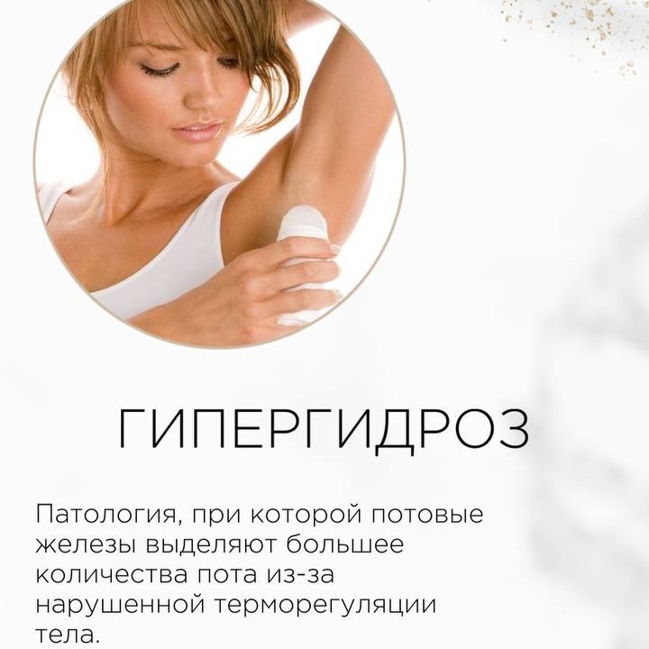 ГИПЕРГИДРОЗ (лечение потливости)