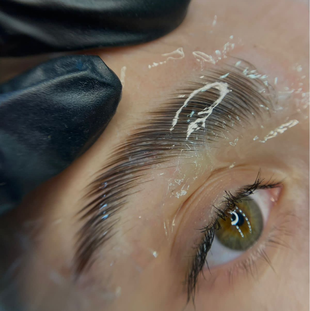 Ботокс для бровей