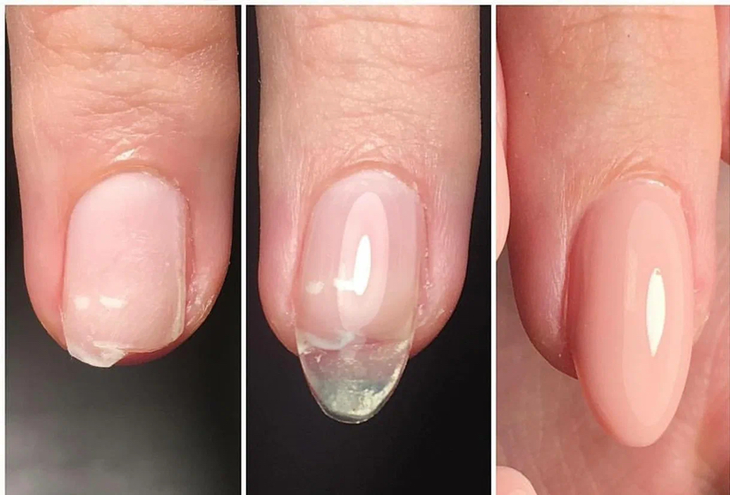 Ремонт ногтя