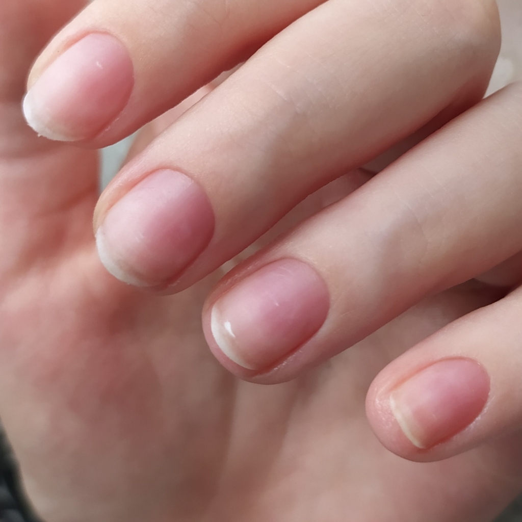 Снятие покрытия