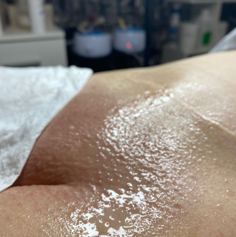 Шугаринг/ваксинг глубокое бикини