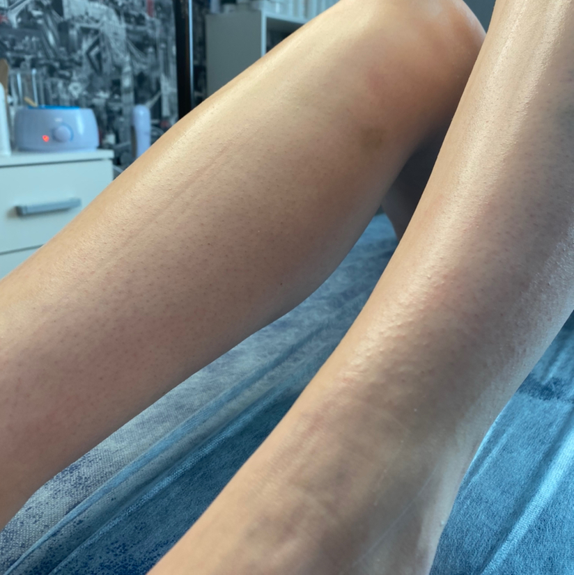 Шугаринг/ваксинг голени/бедра