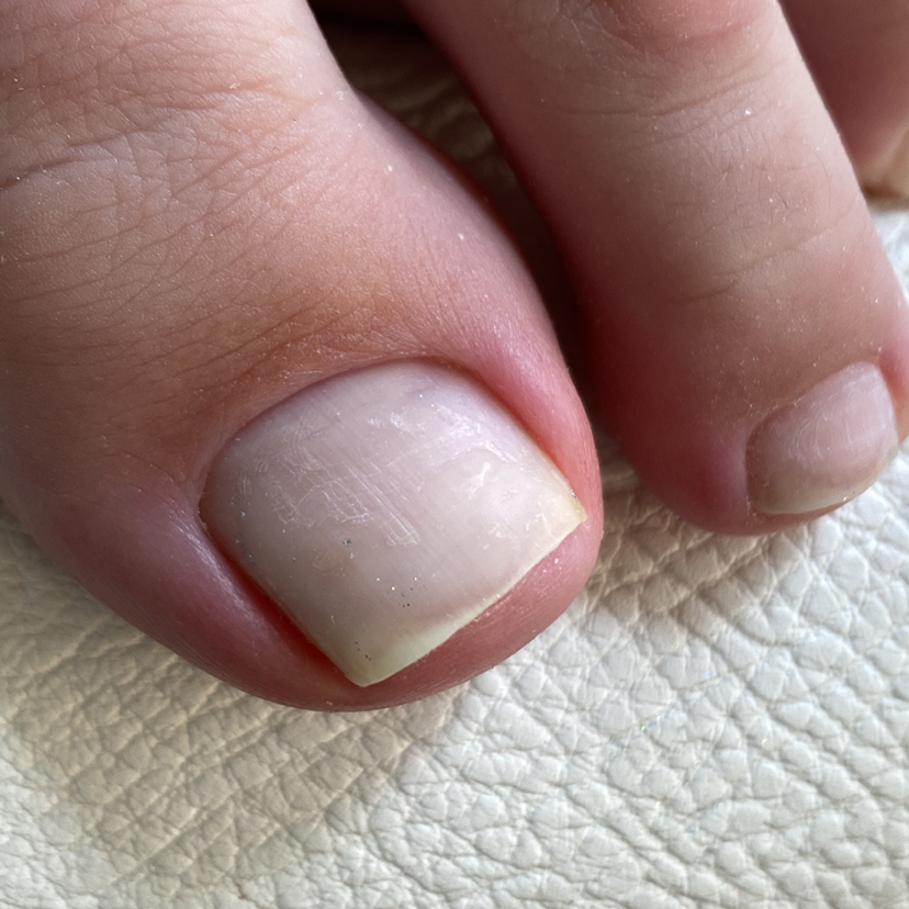 Обработка пальчиков/пятки