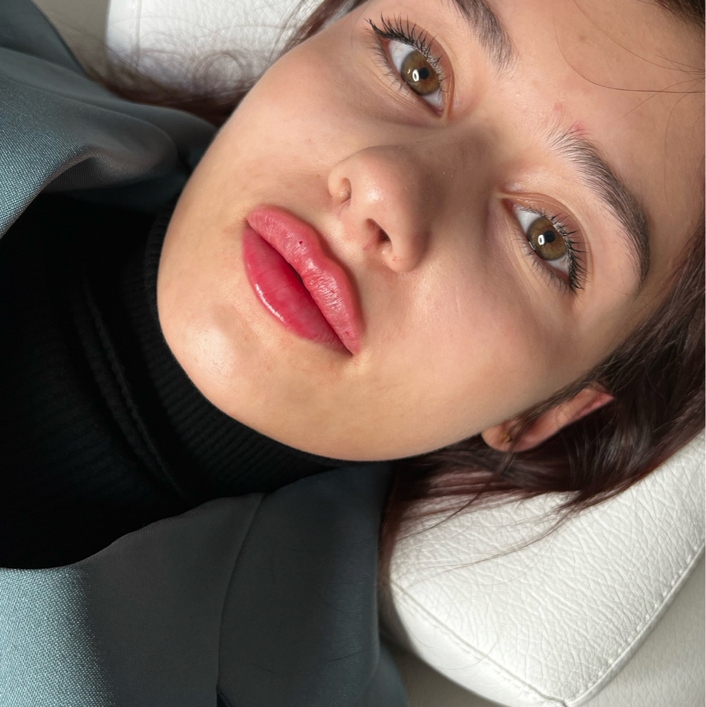 Инъекции.Косметология