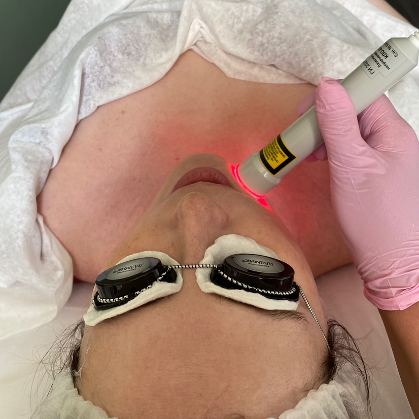 Биоревитализация без инъекций (лицо + шея)