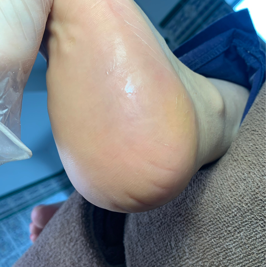 Обработка стоп и ногтей без покрытия Smart