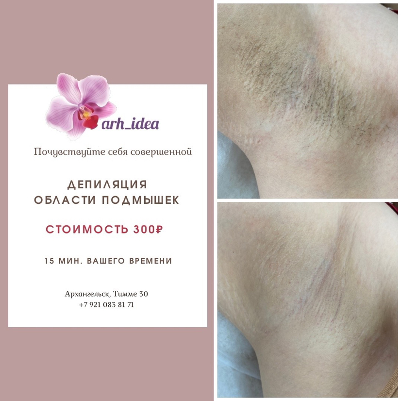 Депиляция зоны подмышки