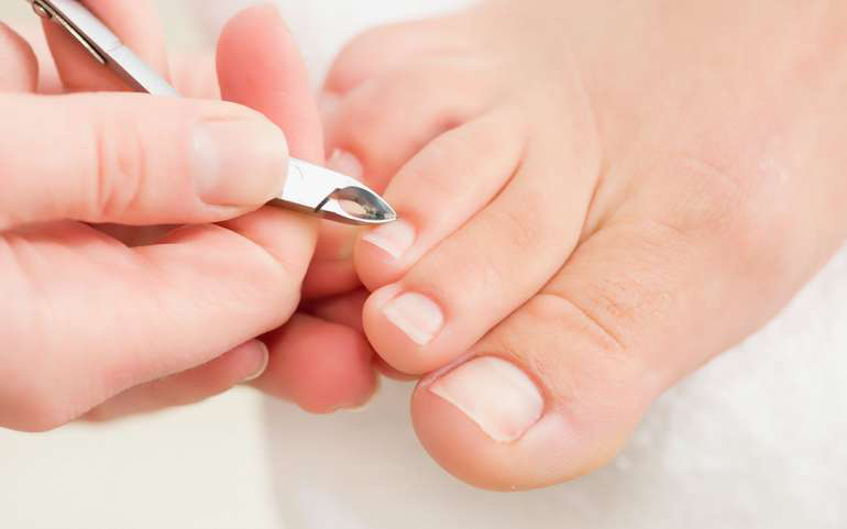 Педикюр гигиенический (обработка пальцев)