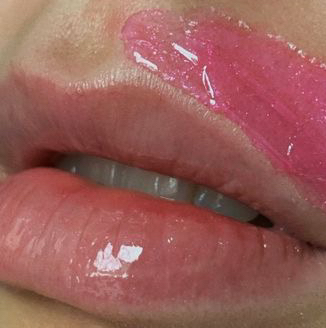 Удаление пушка ( зона на выбор : над губой, подбородок, носовых пазух, бакенбарды )