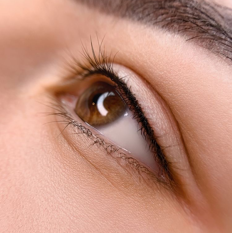Межресничное заполнение век