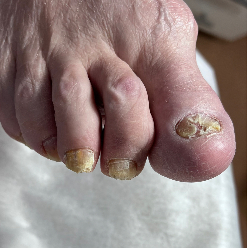 Педикюр сложный (мужской и женский)