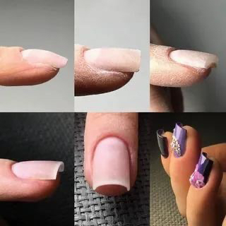 Укрепление акригелем/полигелем