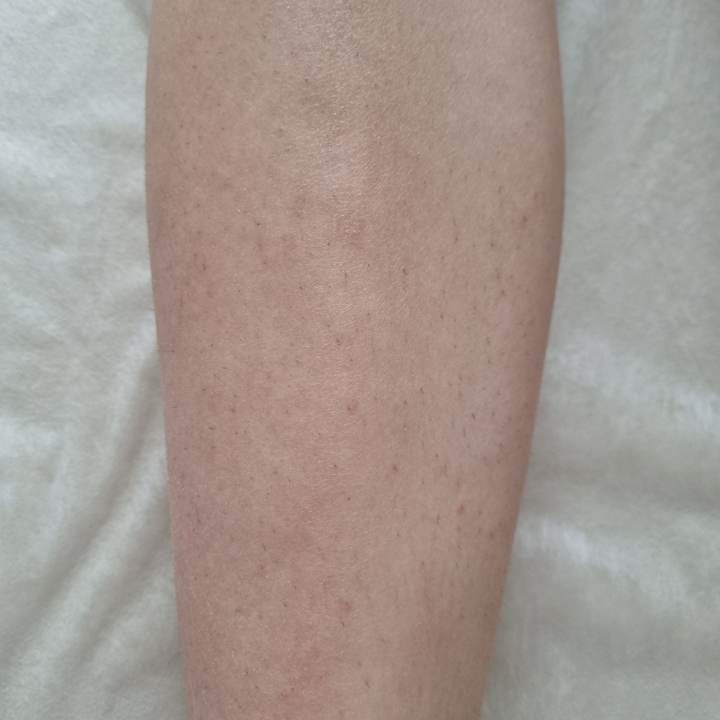 голени/бедра