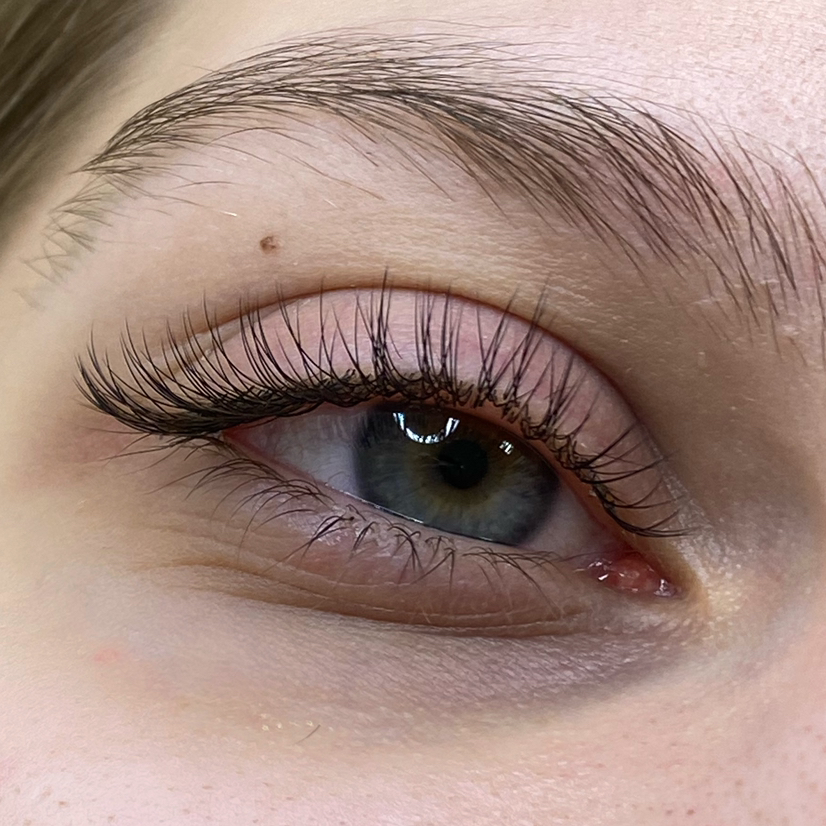 Классическое наращивание (1D)