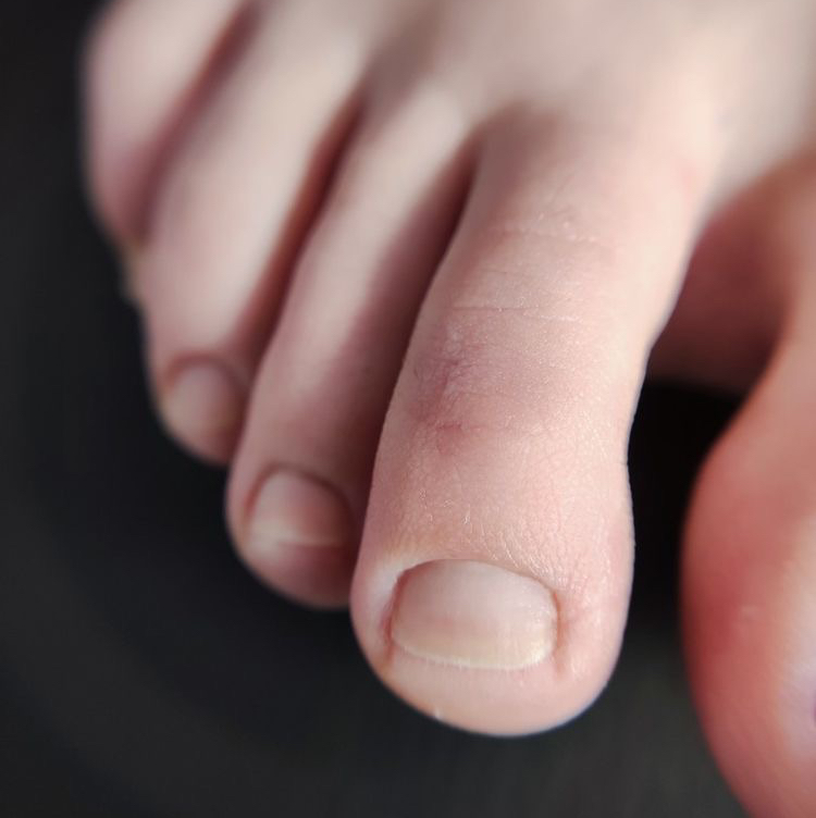 Мужской педикюр