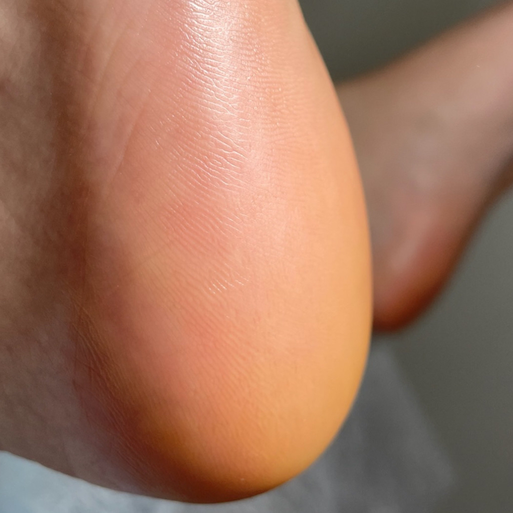 Обработка стопы