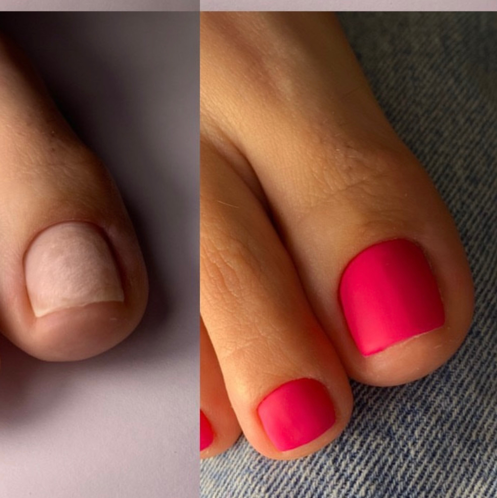 Педикюр пальчики