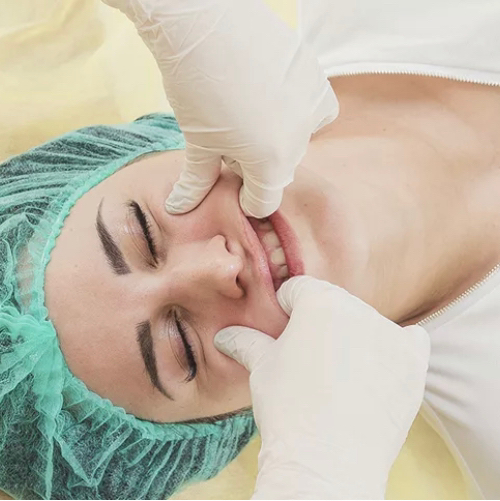 Буккальный массаж