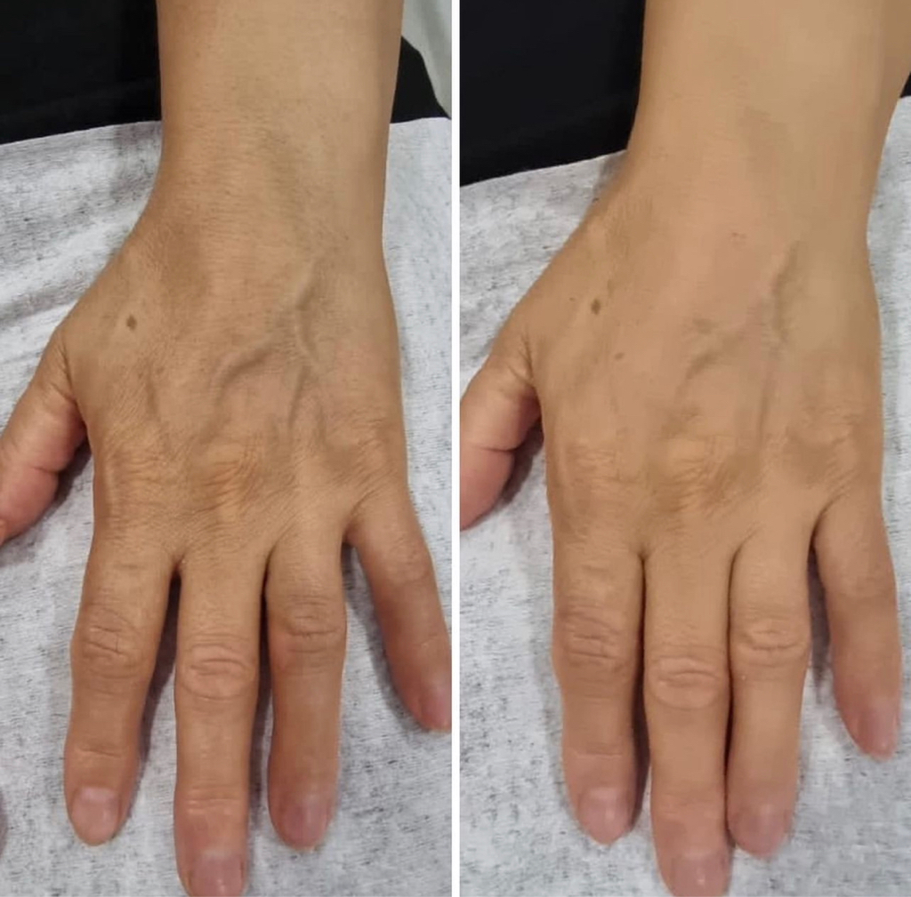 Увлажнение рук, шеи, декольте