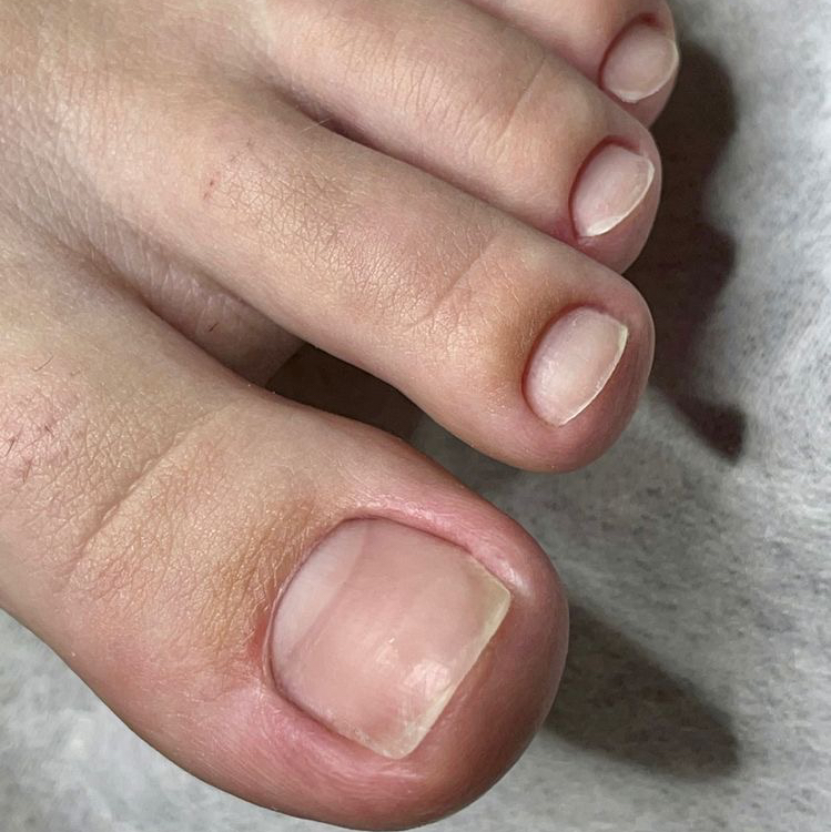 мужской смарт- педикюр