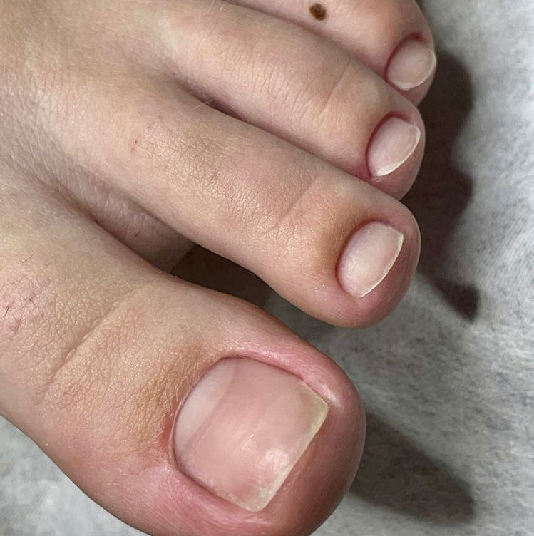 мужской педикюр