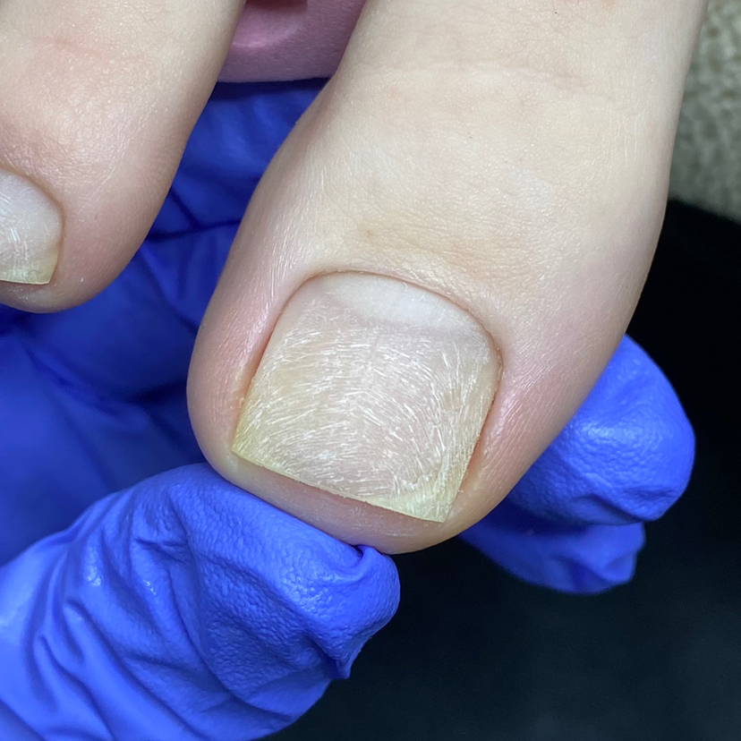 ПЕДИКЮР ГИГИЕНИЧЕСКИЙ ПАЛЬЧИКИ