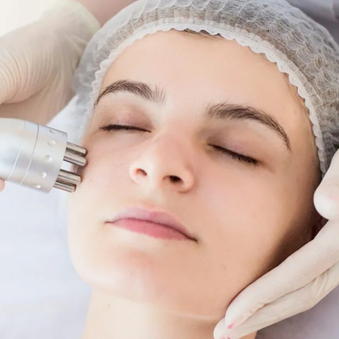 RF- лифтинг лица