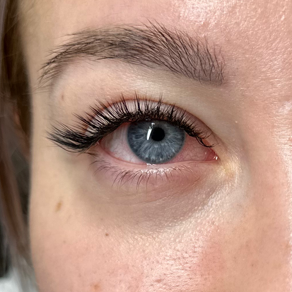 Эффект Кайли (лучи)