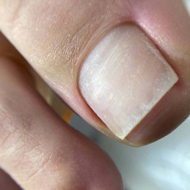 Педикюр гигиенический пальчики