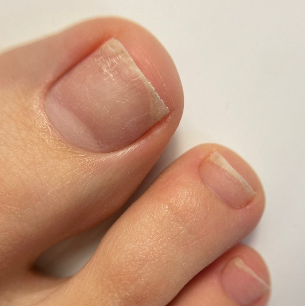 Педикюр пальчиков без покрытия