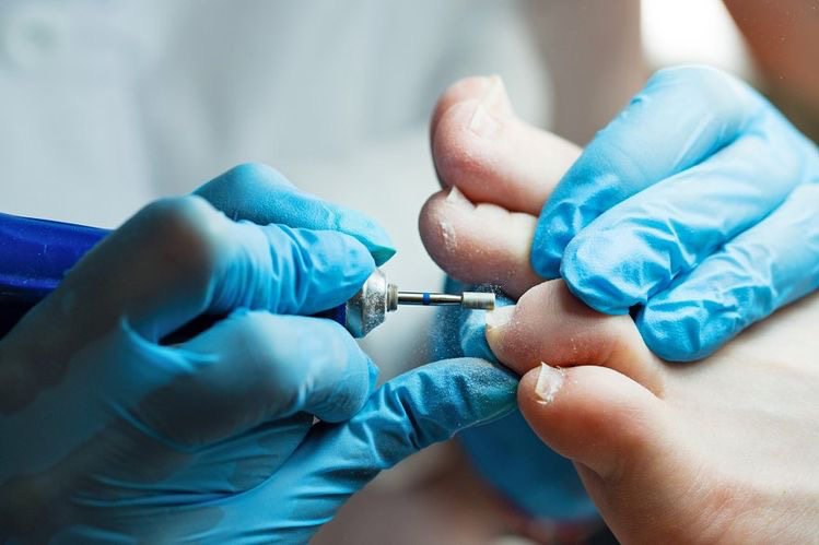 Снятие покрытия без обработки (Педикюр)