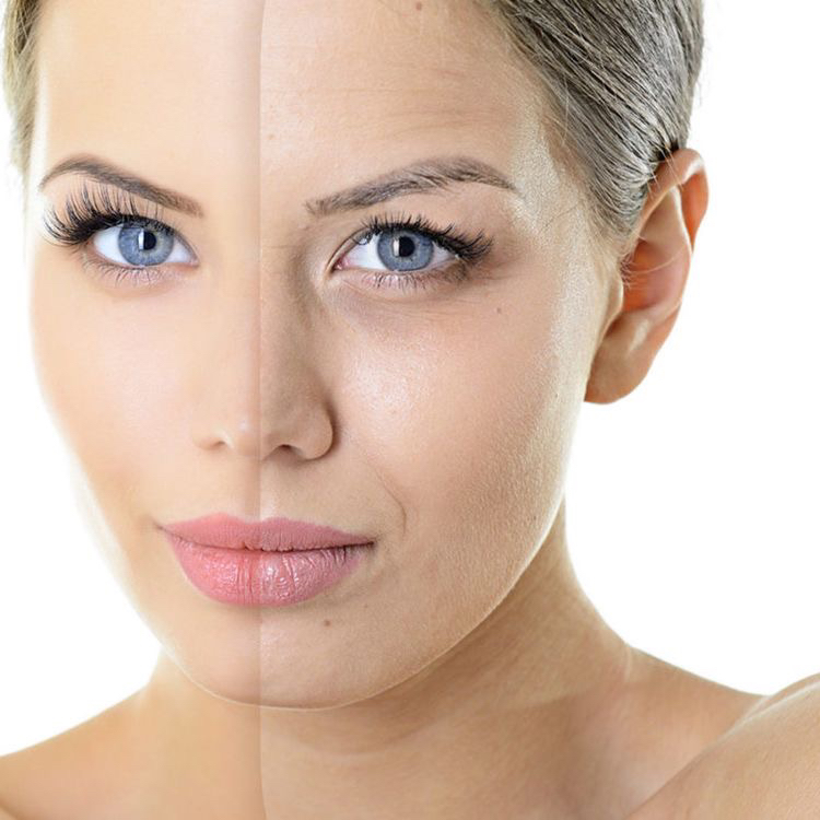 Фотоомоложение диодный лазер лицо