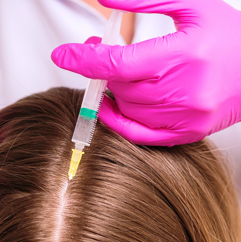 Мезотерапия для волос и кожи головы