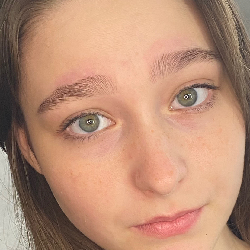 Подростковая коррекция