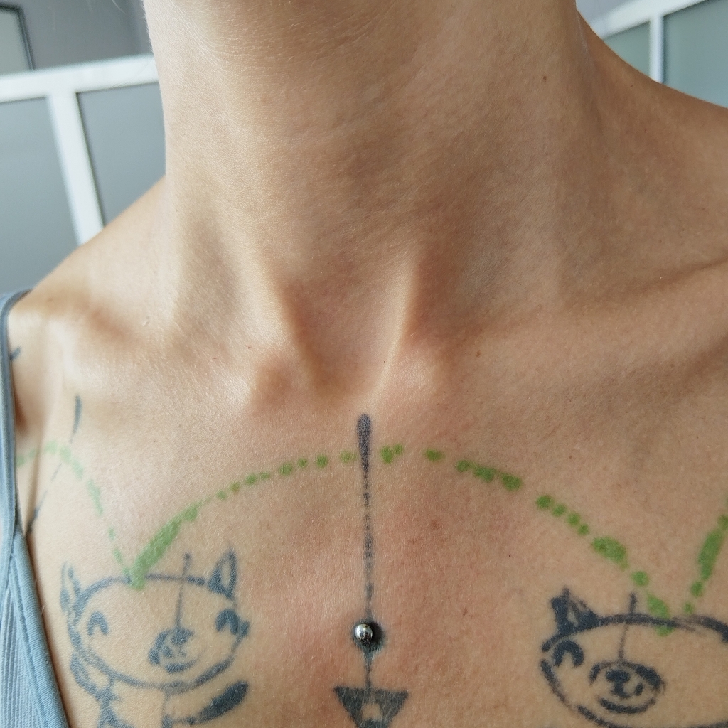 Микродермал Без стоимости украшения.