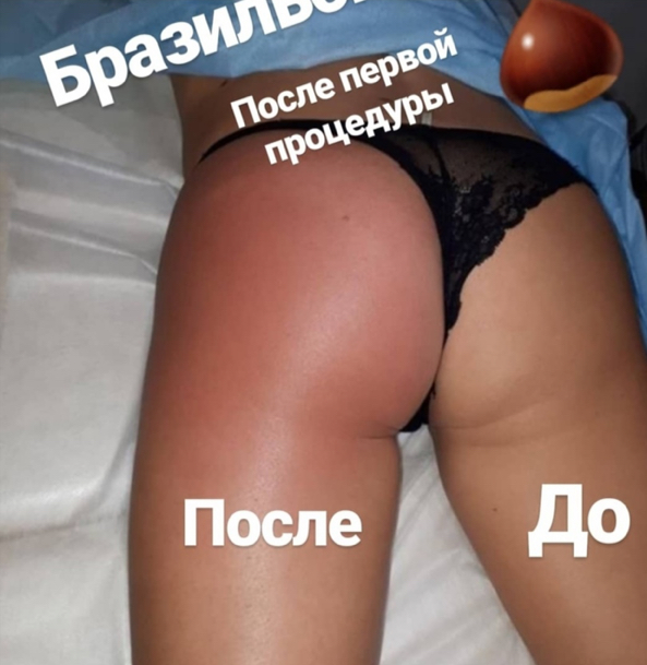 Лицо и Попа (Фёдор Резник) / clubksamata.ru
