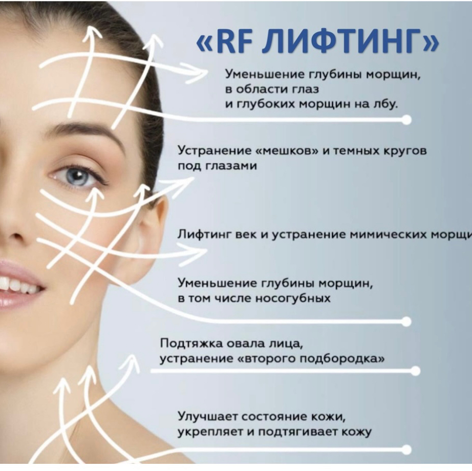 RF Лифтинг (Лицо) с Гиалуроновой Кислотой