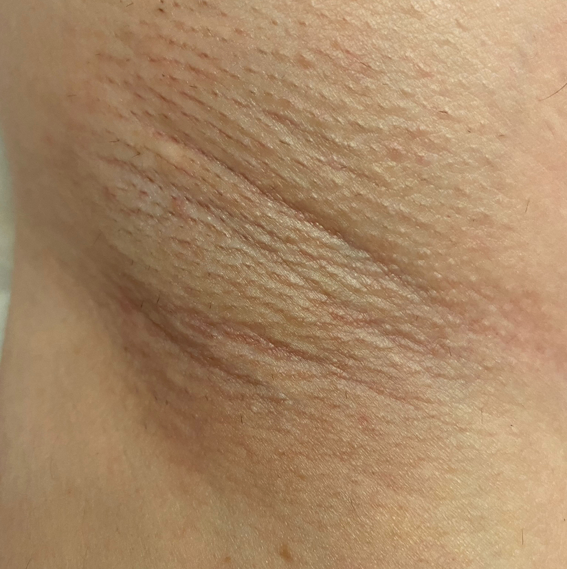 Подмышечные впадины (женские)