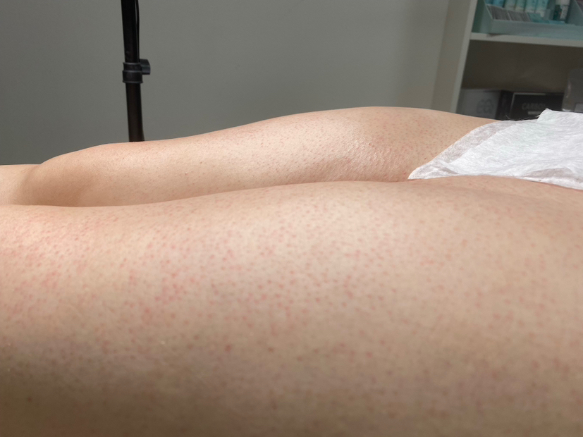 Бёдра (женские)