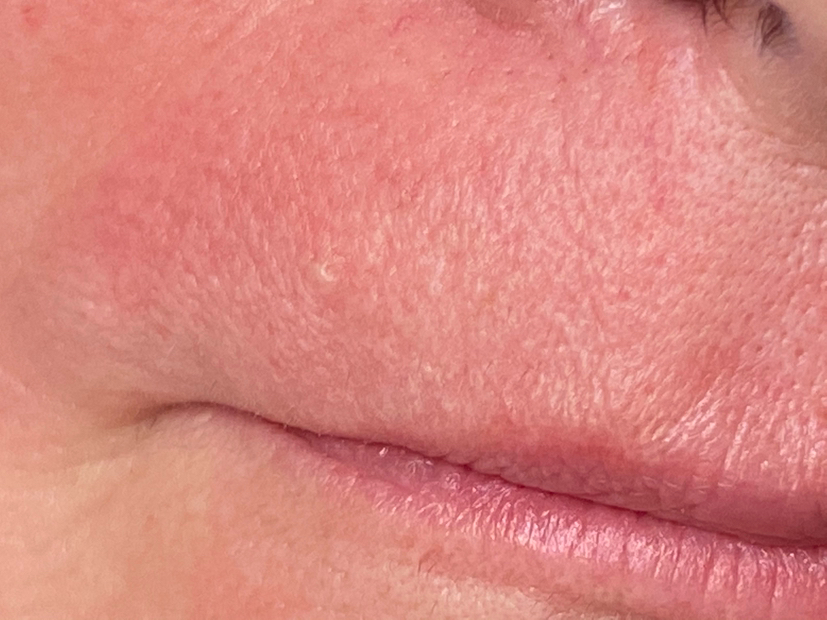 Усики (женские)