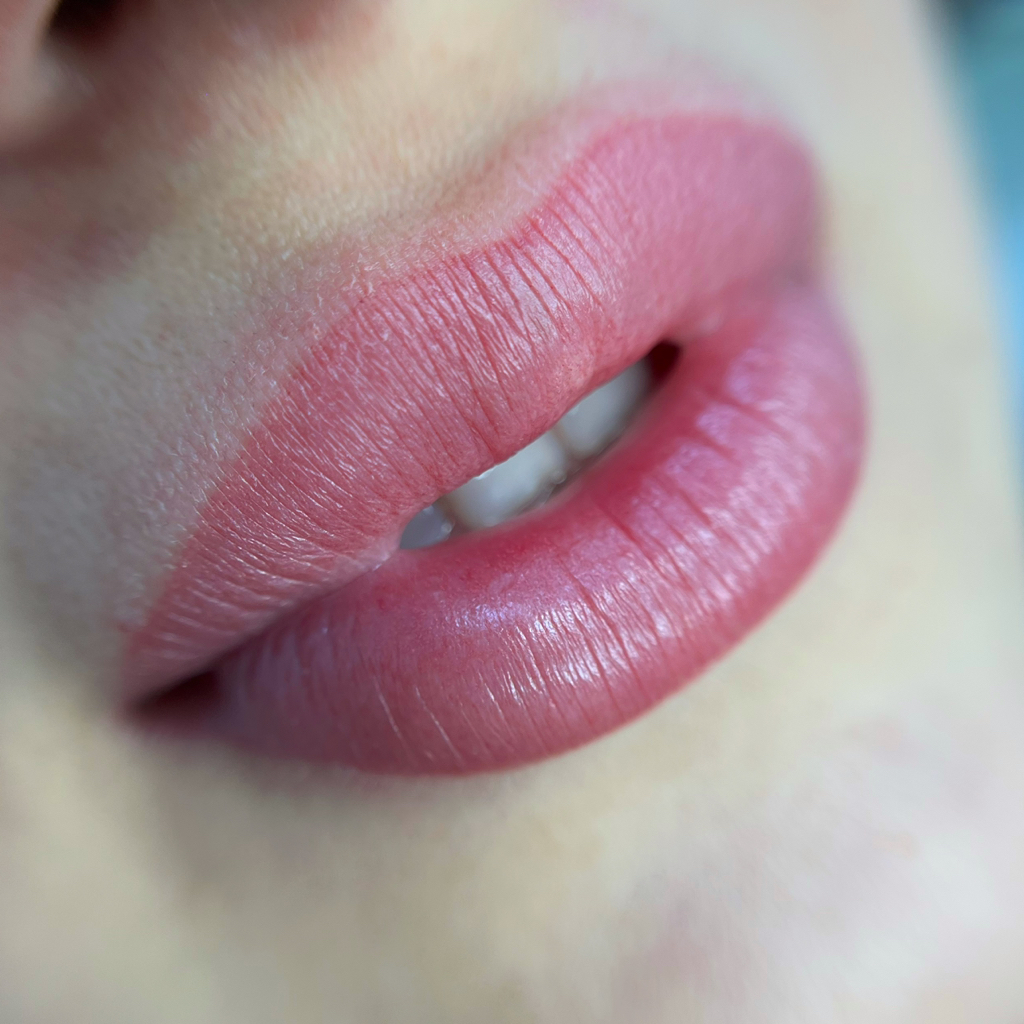 Коррекция акварельных губ через 1-2 месяца после первичной процедуры