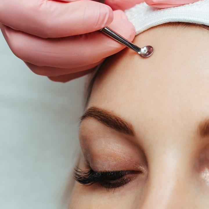 Механическая чистка лица