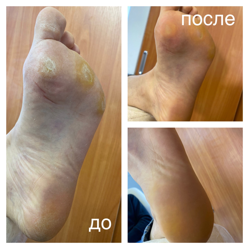 Полный SMART педикюр без покрытия