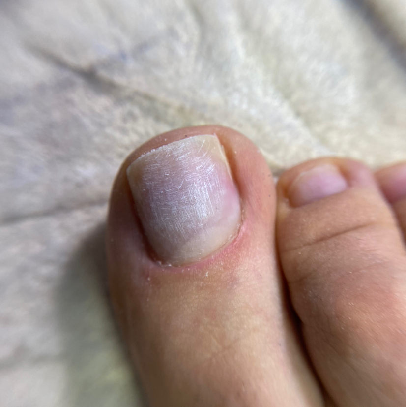 Снятие + педикюр (пальчики)