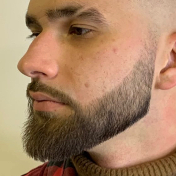 Коррекция бороды