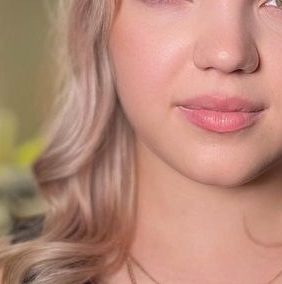 Депиляция любой зоны лица