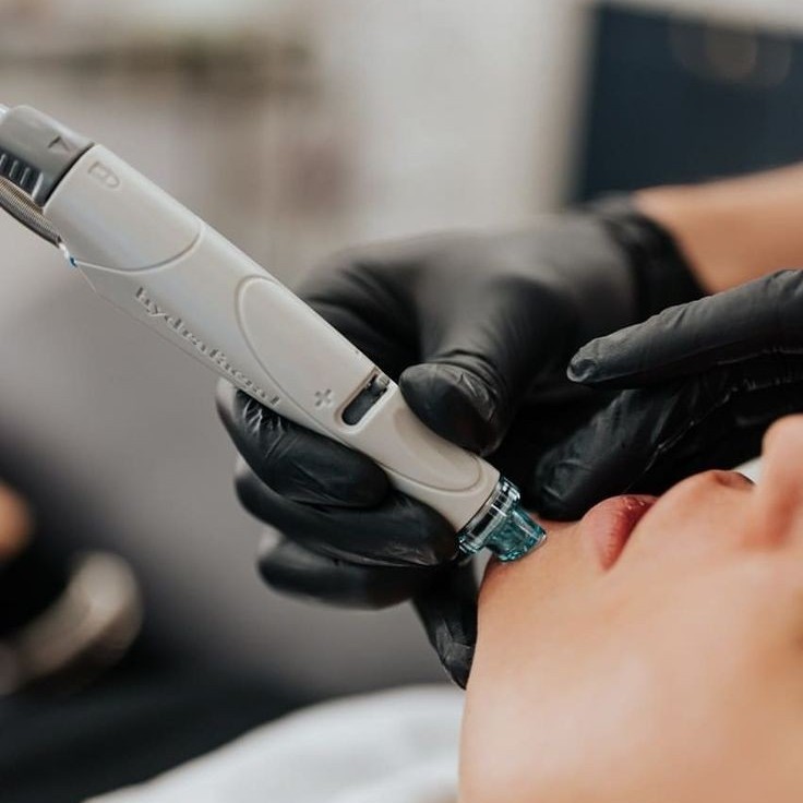 Hydra Facial