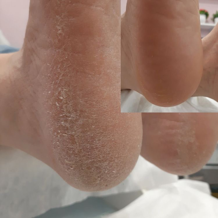 Педикюр (стопы) без покрытия