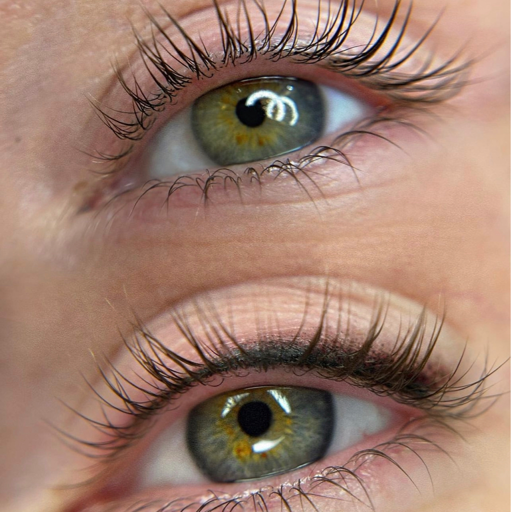 •Снятие ресниц•